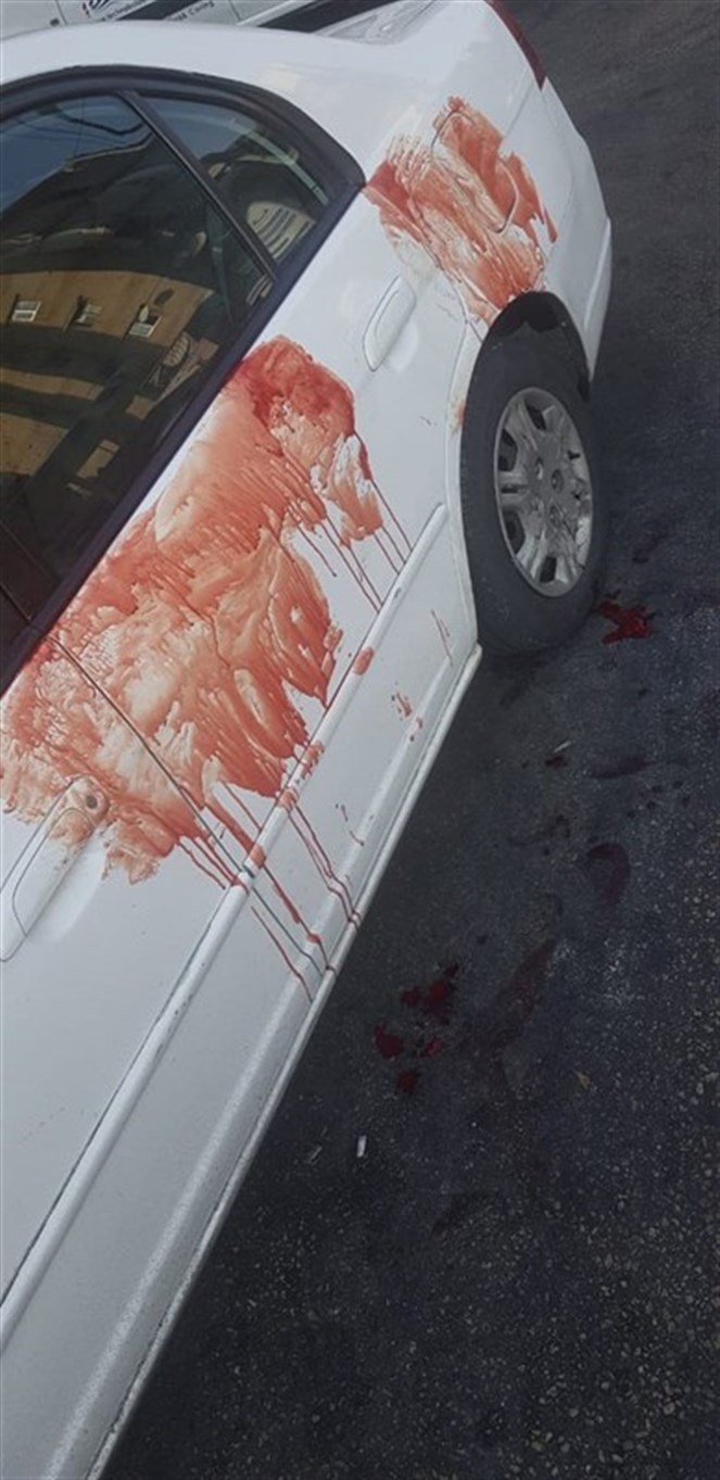 تعرّض مواطن الى طعنات عدة بين الصالومي وميرنا الشالوحي بعد سجال بسبب محاولته المرور