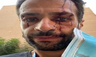 مالك مكتبي مضرجاً بالدماء ويروي لحظات الرعب: أين نايلة ماذا حلّ بالأولاد؟