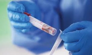 كورونا يخطف طبيباً لبنانياً