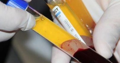 أيها اللبنانيون... بلازما دمائكم تُباع في السوق السوداء