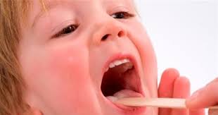 متى يمكن أن يكون التهاب الحلق خطيرا؟