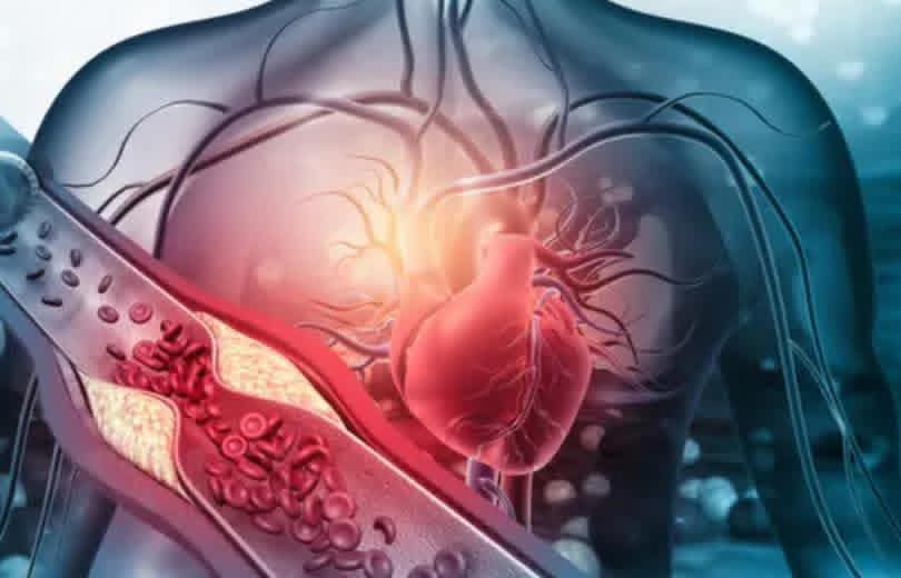 7 علامات يومية تنذر بنوبة قلبية