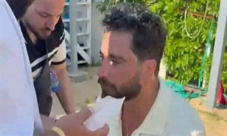 معتصم النهار يتعرّض لإصابة في الوجه أثناء تصوير فيلمه "نصيب"