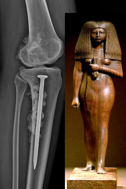 المومياوات المصرية العائدة لامرأة