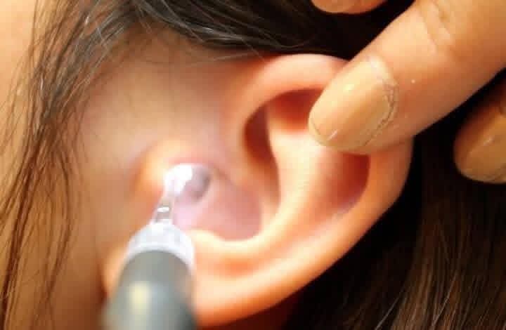 شحمة الأذن تنذرُ بجلطة دماغية.. كيف ذلك؟