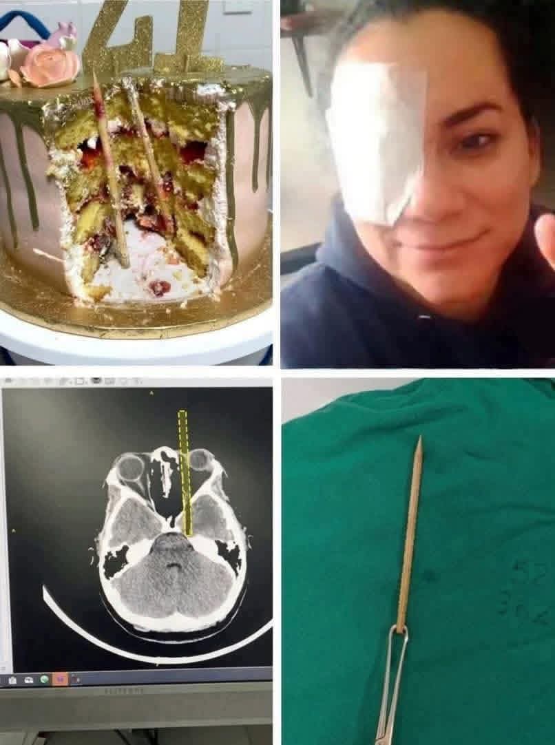 ما كان يُفترض أن يكون مزحة كاد أن يتحول إلى إصابة تُغير مجرى الحياة.