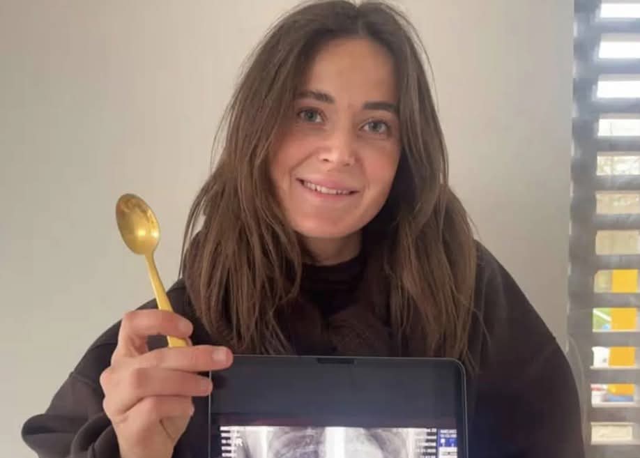 قفزة كلب تنتهي بملعقة في معدة شابة بلجيكية   