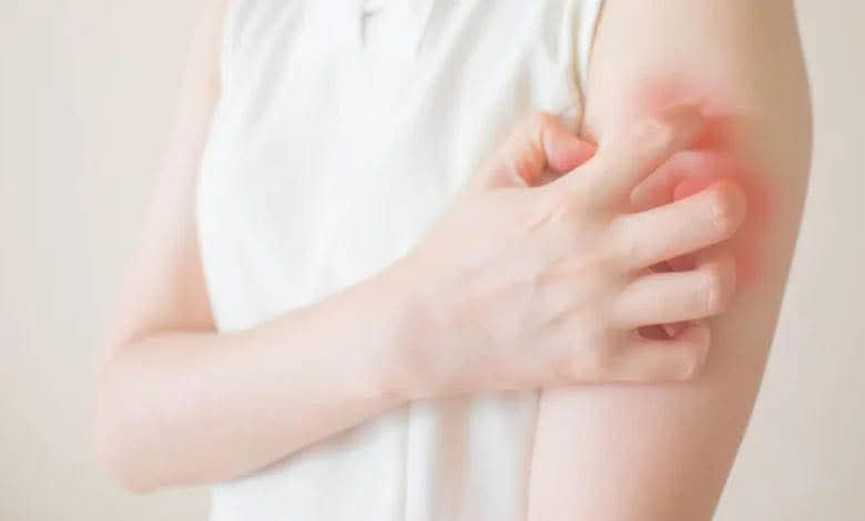 عدوى جديدة تثير المخاوف… والقلق يرافق ظهورها في لبنان*