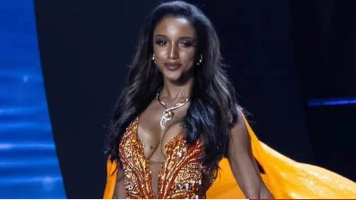 بعد سقوطها في مسابقة ملكة جمال الكون... تطور صحي لافت في حالة ملكة جمال جامايكا