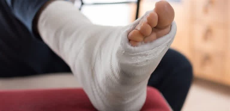 ملحن شهير يتعرّض لكسر في القدم