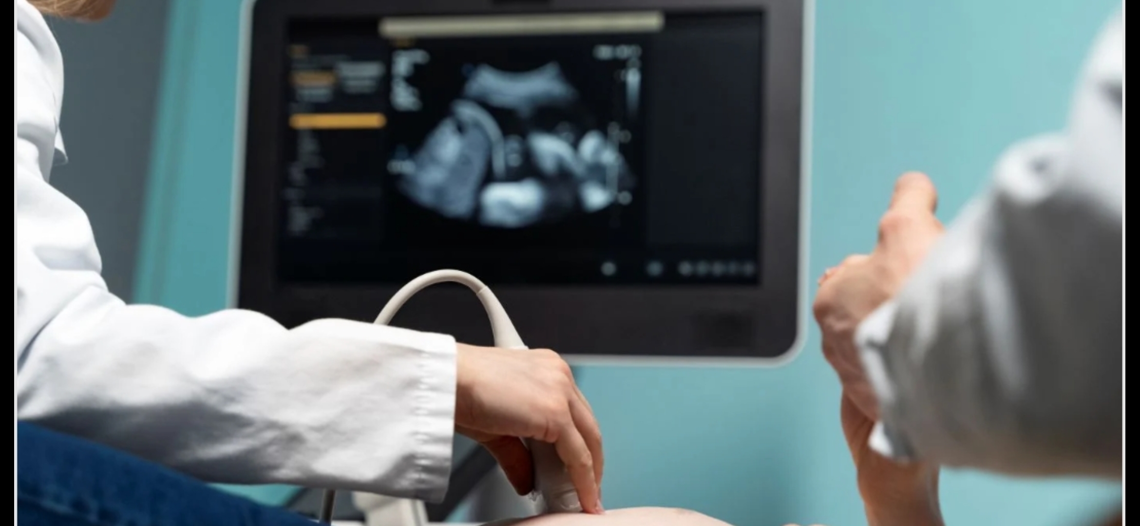 13 ألف حامل في مرمى القلق