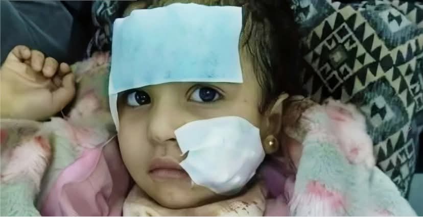 أسد يهاجم طفلة في مصر أثناء التقاط صورة تذكارية في السيرك القومي