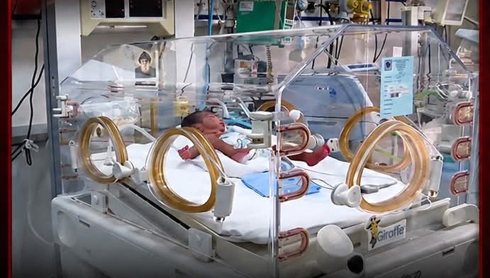 إنجاز طبي في "أوتيل ديو": استئصال ورم في الغدة الكظرية لدى طفل باستخدام تقنية التنظير خلف الصفاق
