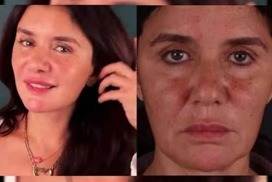 بعد اعتراف غادة عادل..نجمات كشفن تشوهات غير متوقعة وخطرة لعمليات التجميل